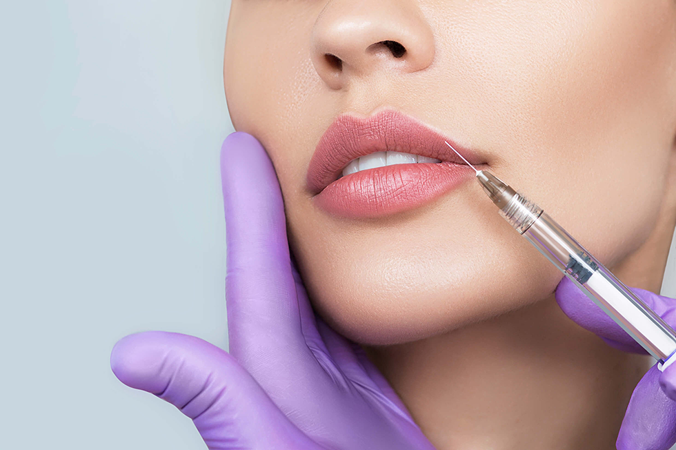 Lips Fillers: What to Expect, Types, Benefits & Side Effects